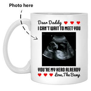 Pregnancy Sonogram Custom Photo Coffee Mugs