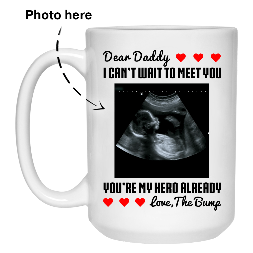 Pregnancy Sonogram Custom Photo Coffee Mugs