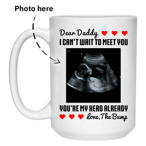 Pregnancy Sonogram Custom Photo Coffee Mugs